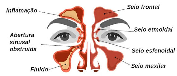 Quando a Cirurgia se Torna Necessária - inspiração 1