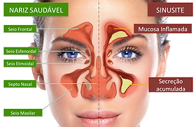 Quando a Cirurgia se Torna Necessária - inspiração 2