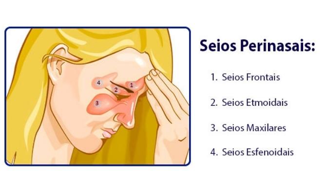 Identifique os Sinais: Não Ignore a Dor Profunda na Cabeça - inspiração 1