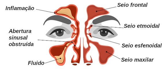 Lavagem Nasal Correta: A Chave Para Desobstruir - inspiração 2