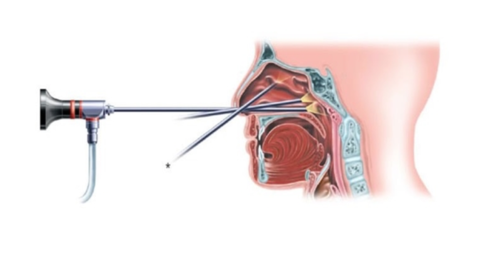 Evite Gatilhos: O Que Te Faz Piorar? - inspiração 2