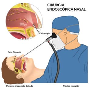 Cuidados Pós-Tratamento e Prevenção - inspiração 1