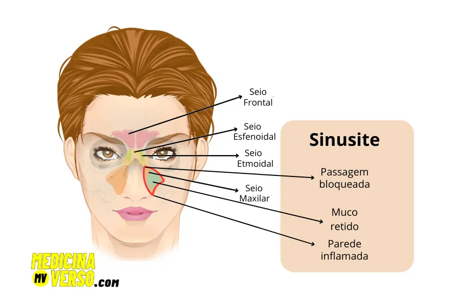 A Importância da Higiene Nasal - inspiração 2