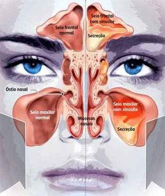 Quando Buscar Ajuda Médica Profissional - inspiração 1