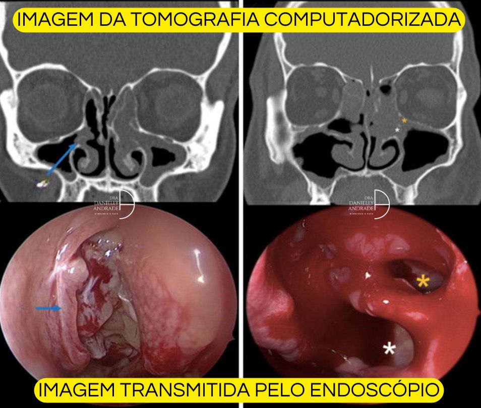 Opções de Tratamento Medicamentoso Prescrito - inspiração 1