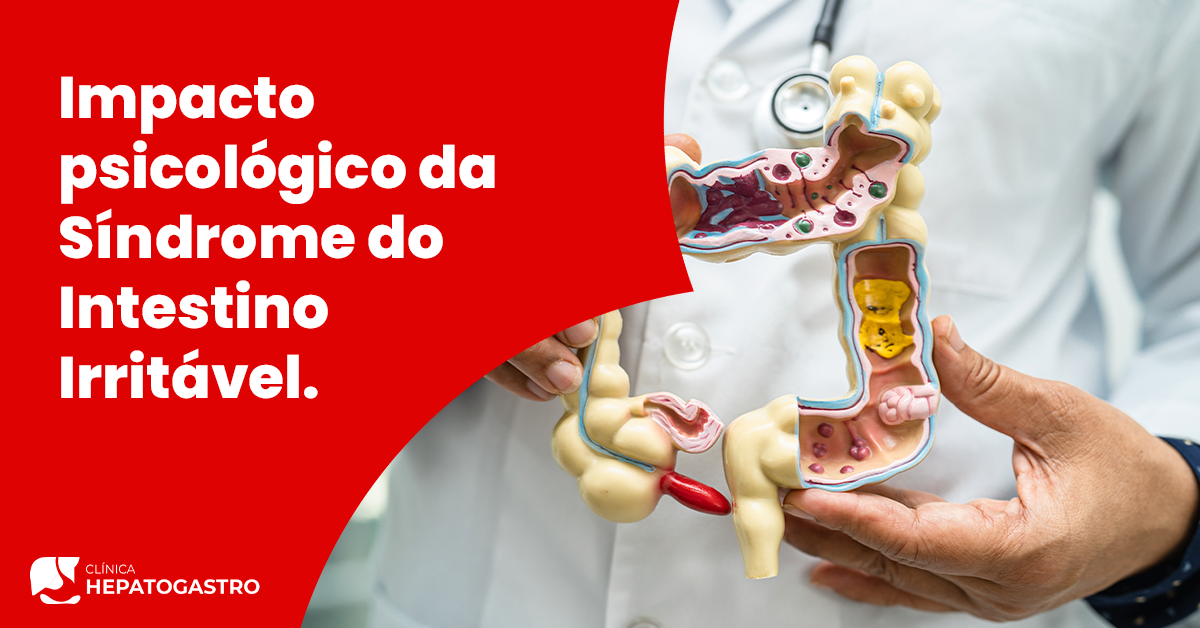 Alimentos a priorizar: nutrir seu intestino com o que faz bem - inspiração 2