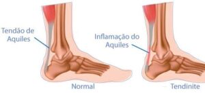 Repouso: A Primeira Medida Essencial - inspiração 1
