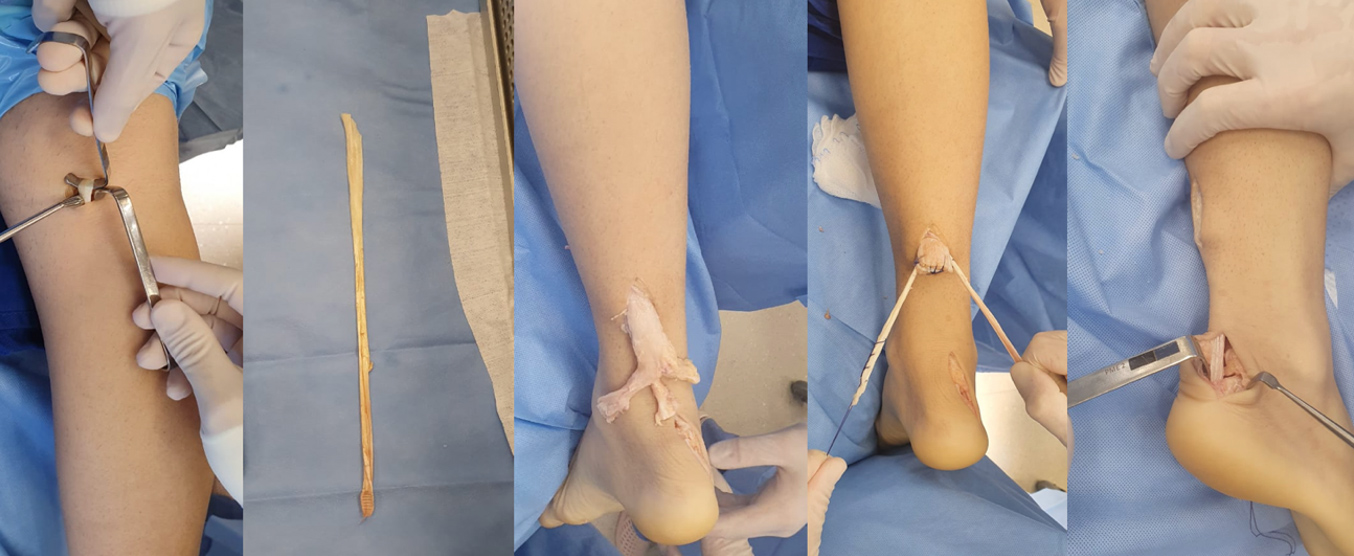 Repouso: A Primeira Medida Essencial - inspiração 2