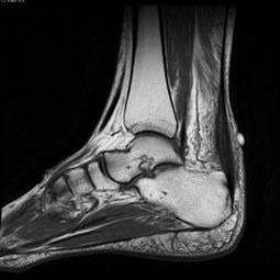 Evitando Recorrências: Cuidados Pós-Tratamento - inspiração 1