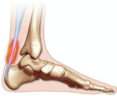 Alongamento: Mobilidade e Flexibilidade para o Tendão - inspiração 2