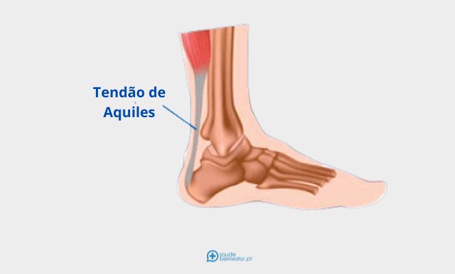 Medicação: Quando e Como Usar Anti-inflamatórios - inspiração 2