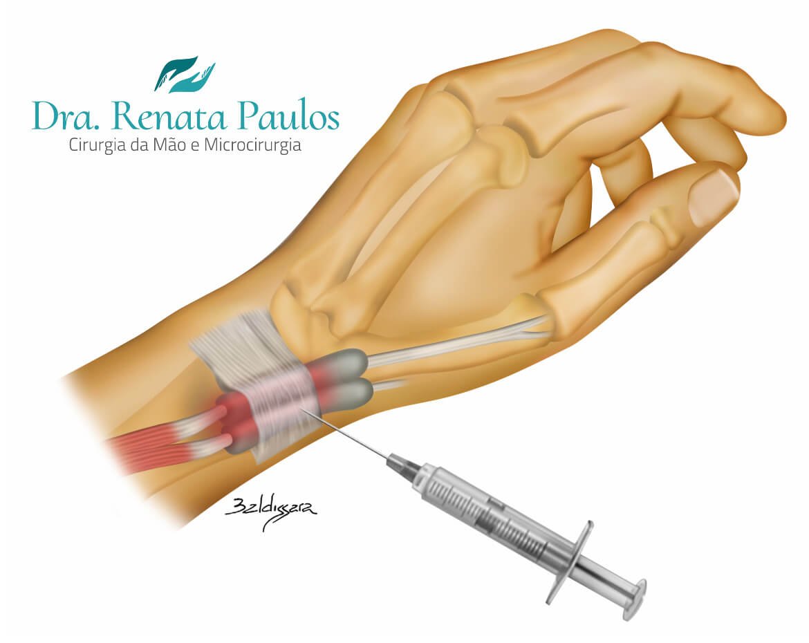 Por que essa dor aparece tanto em nós? - inspiração 2