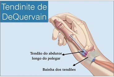 Sintomas que você não pode ignorar - inspiração 2