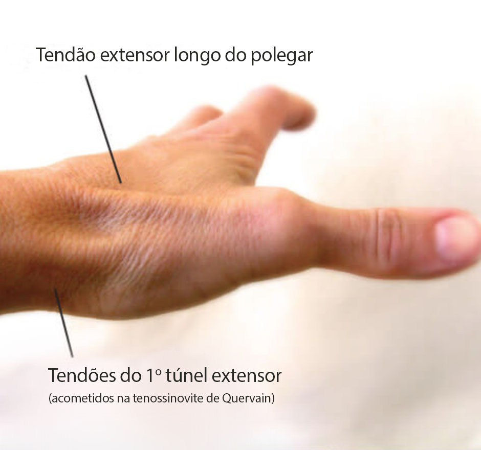 Tratamentos caseiros: Alívio imediato para você - inspiração 1