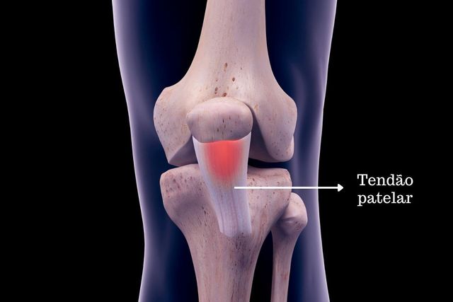 Fortalecimento Muscular: Músculos Fortes Protegem Seu Joelho - inspiração 1