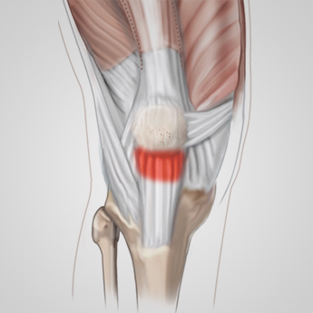 Quando Buscar Ajuda Médica Urgente: Sinais de Alerta - inspiração 2