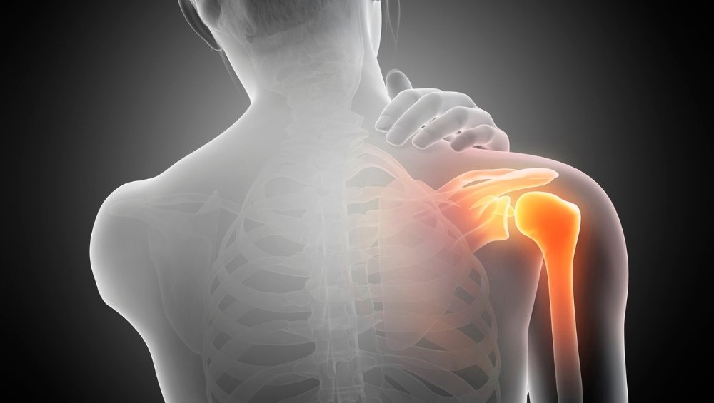 O que é tendinite e como ela afeta ombro e pescoço? - inspiração 2