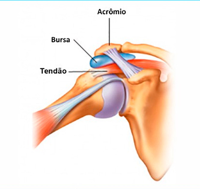 As causas mais comuns por trás dessa dor incômoda. - inspiração 1