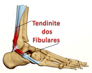 Fortalecimento Progressivo: Músculos Mais Resistentes - inspiração 1