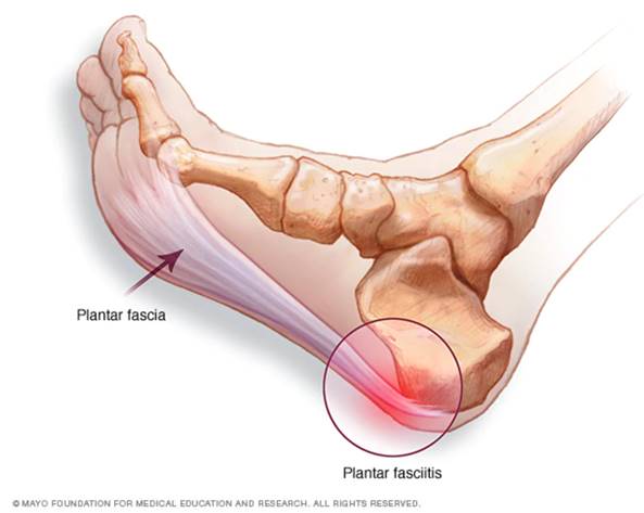 Medicamentos e Anti-inflamatórios: Quando e Como Usar com Orientação - inspiração 1