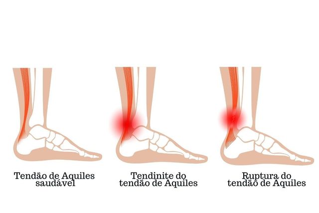 Prevenção de Recorrências: Estratégias para o Futuro - inspiração 1