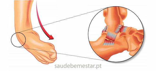 Prevenção de Recorrências: Estratégias para o Futuro - inspiração 2