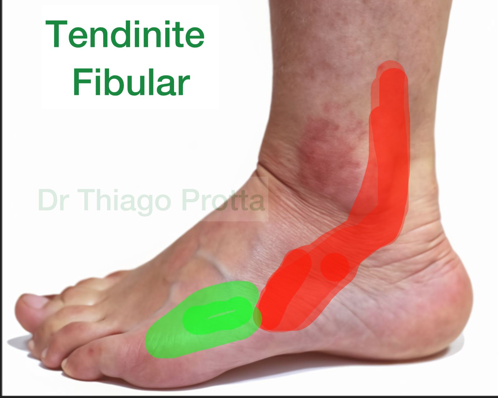 A Importância da Fisioterapia Especializada - inspiração 1