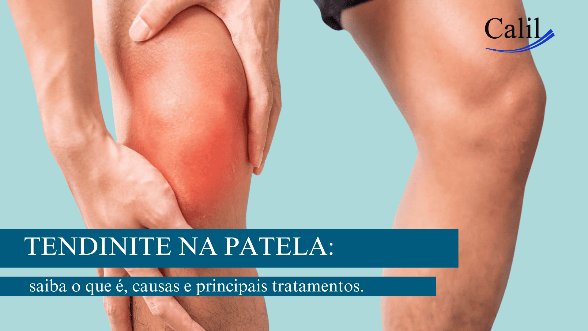 Descanso Estratégico: O Primeiro Passo para Aliviar a Inflamação - inspiração 2