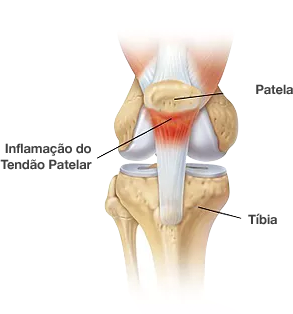 Alongamentos Delicados para Recuperar a Mobilidade - inspiração 2