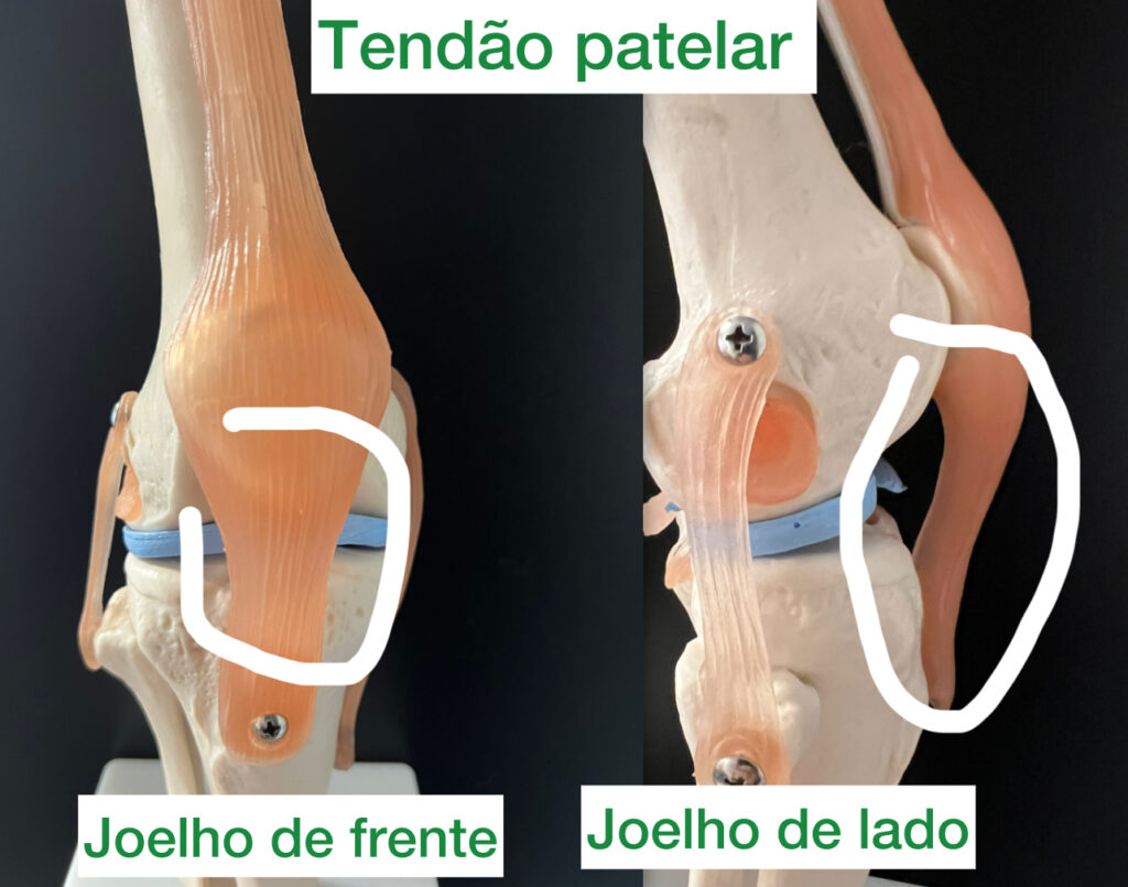 Nutrição Aliada: Alimentação que Combate a Inflamação - inspiração 1