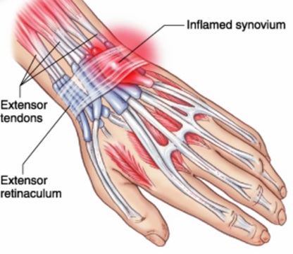 Técnicas de Alongamento para Alívio Imediato - inspiração 2