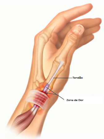 Ajustes Ergonômicos no Dia a Dia: Seu Aliado Principal - inspiração 2