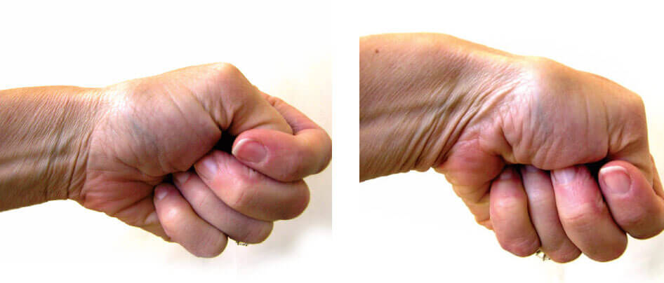 O Papel da Fisioterapia na Sua Recuperação Completa - inspiração 2