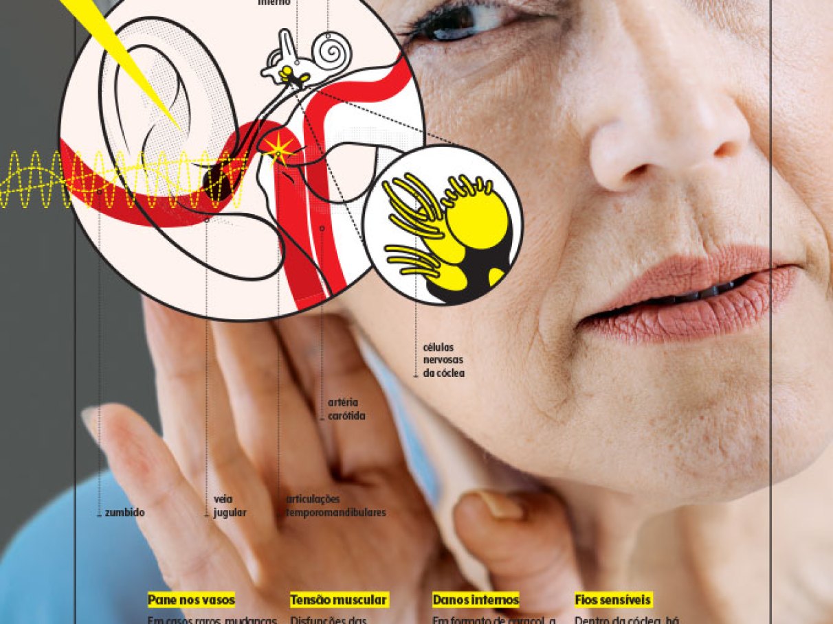 Identifique os Gatilhos Comuns do Zumbido - inspiração 2