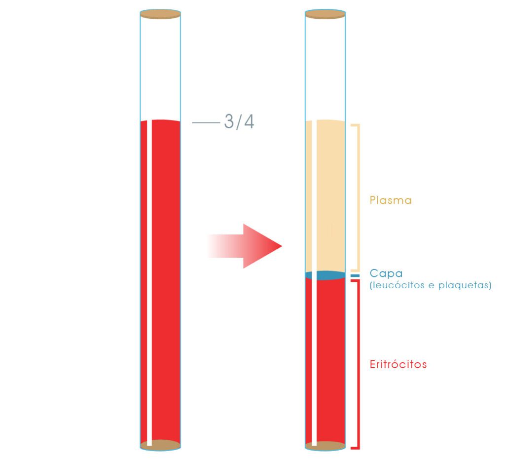 Entendendo a Faixa de Referência: Valores Ideais para Você - inspiração 1
