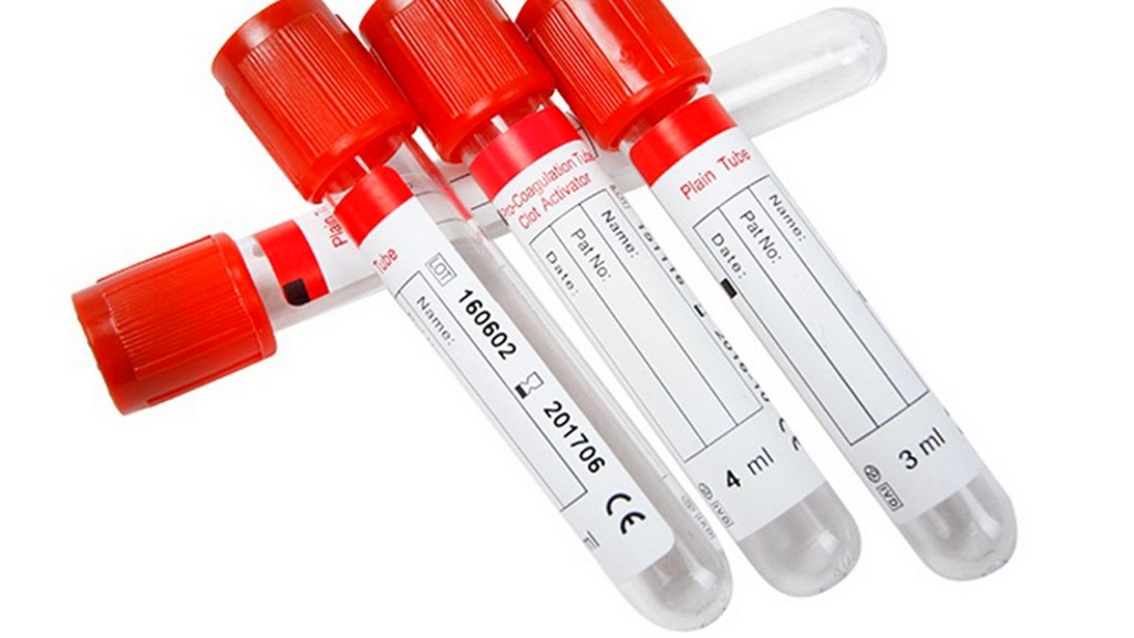 O Papel da Hidratação nos Níveis de Hematócrito - inspiração 2