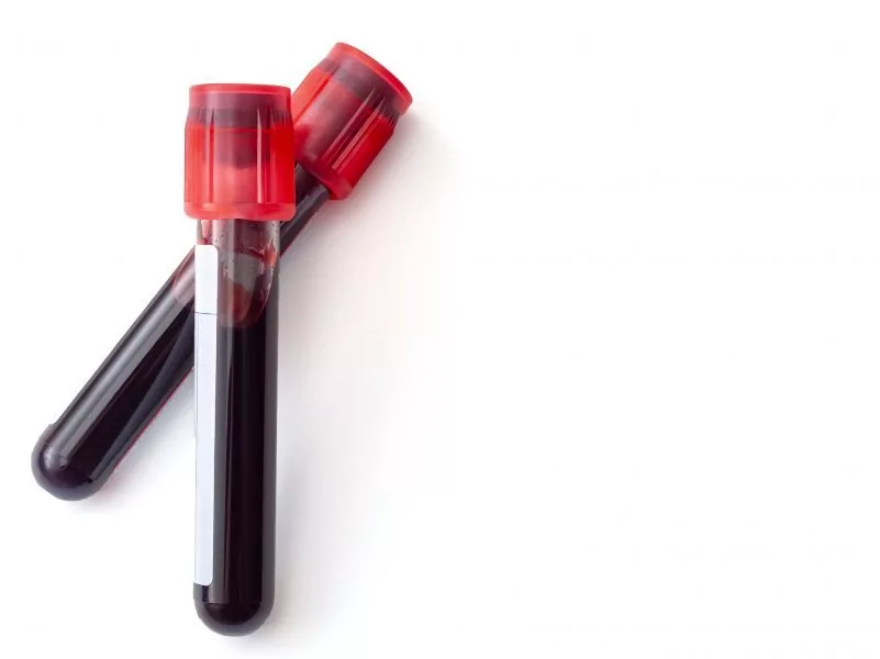 O Impacto de Doenças Crônicas no Hematócrito - inspiração 2