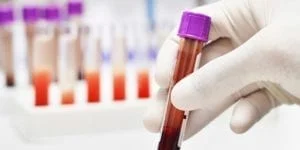 A Diferença Entre Linfócitos Reativos e Linfócitos Atípicos - inspiração 2