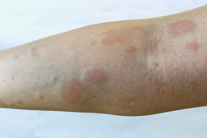 Quando procurar um dermatologista: sinais de alerta - inspiração 1