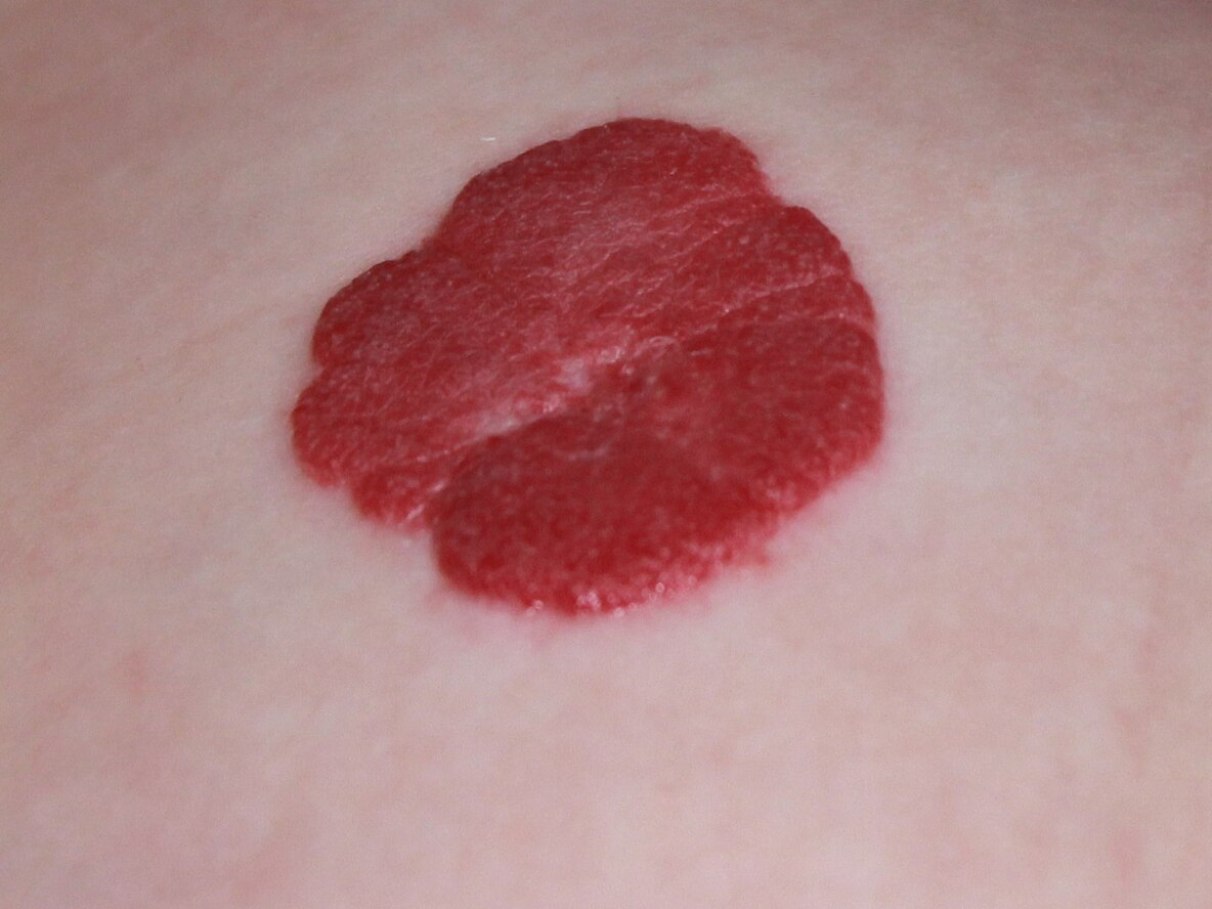 Quando procurar um dermatologista: sinais de alerta - inspiração 2