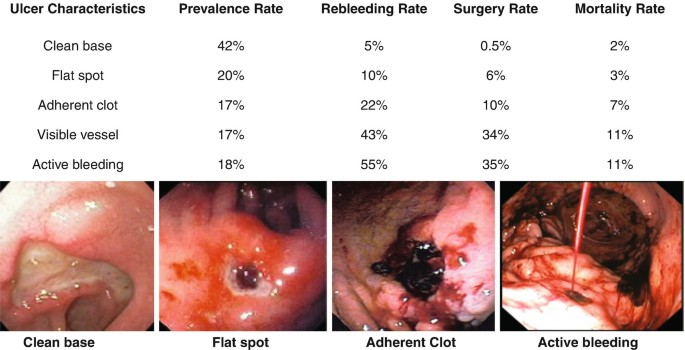 Produtos Certos: Escolhendo o Melhor para Sua Melena - inspiração 1
