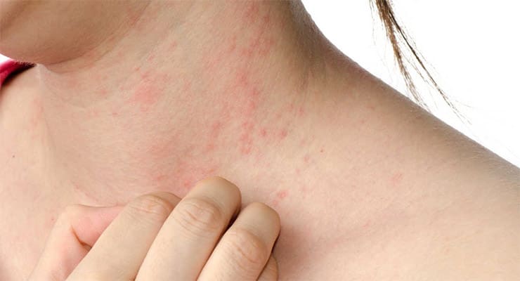 Fotografando os Sintomas: Ajuda para o Diagnóstico - inspiração 2