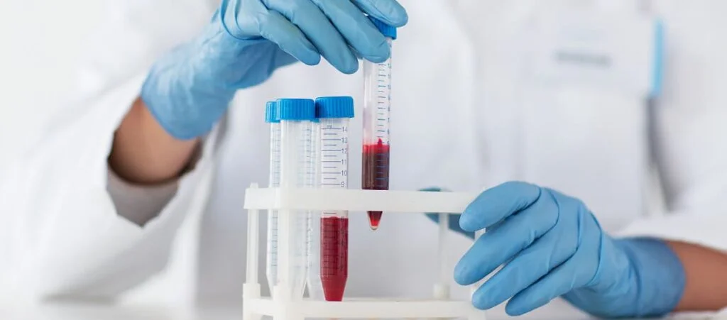 Quando se preocupar com um resultado de PCR alto - inspiração 2