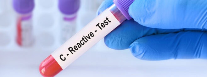 Diferença entre PCR e PCR de alta sensibilidade (PCR-AS) - inspiração 2