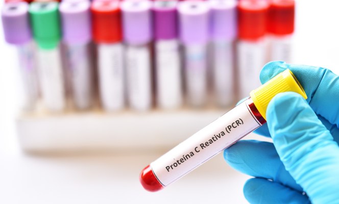 Prevenindo a inflamação crônica para manter a PCR baixa - inspiração 2