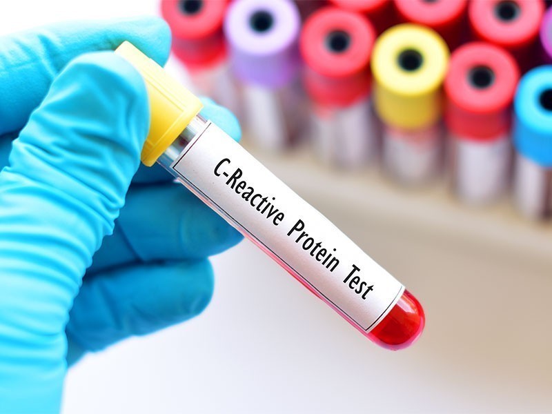 O Que É Exatamente a Proteína C Reativa (PCR)? - inspiração 1