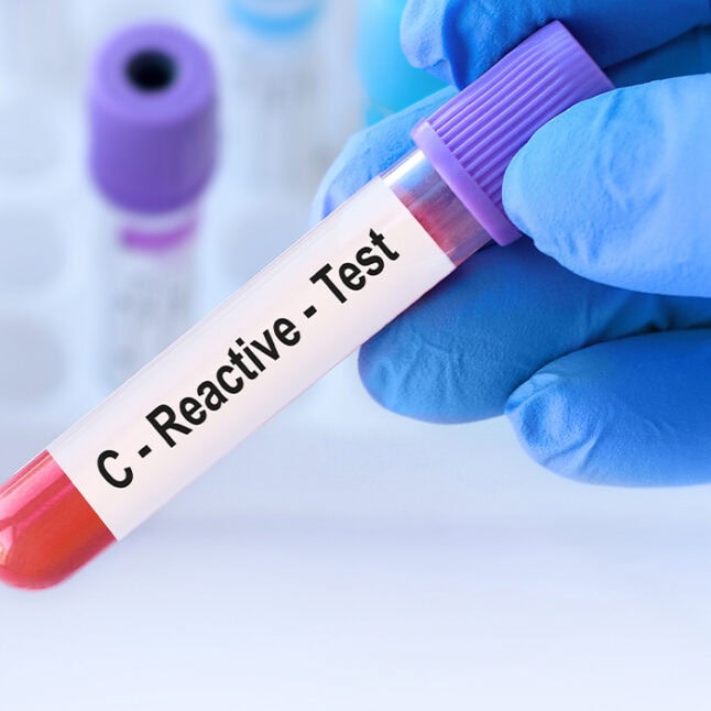 Como a PCR Pode Indicar Riscos à Saúde Cardiovascular - inspiração 2