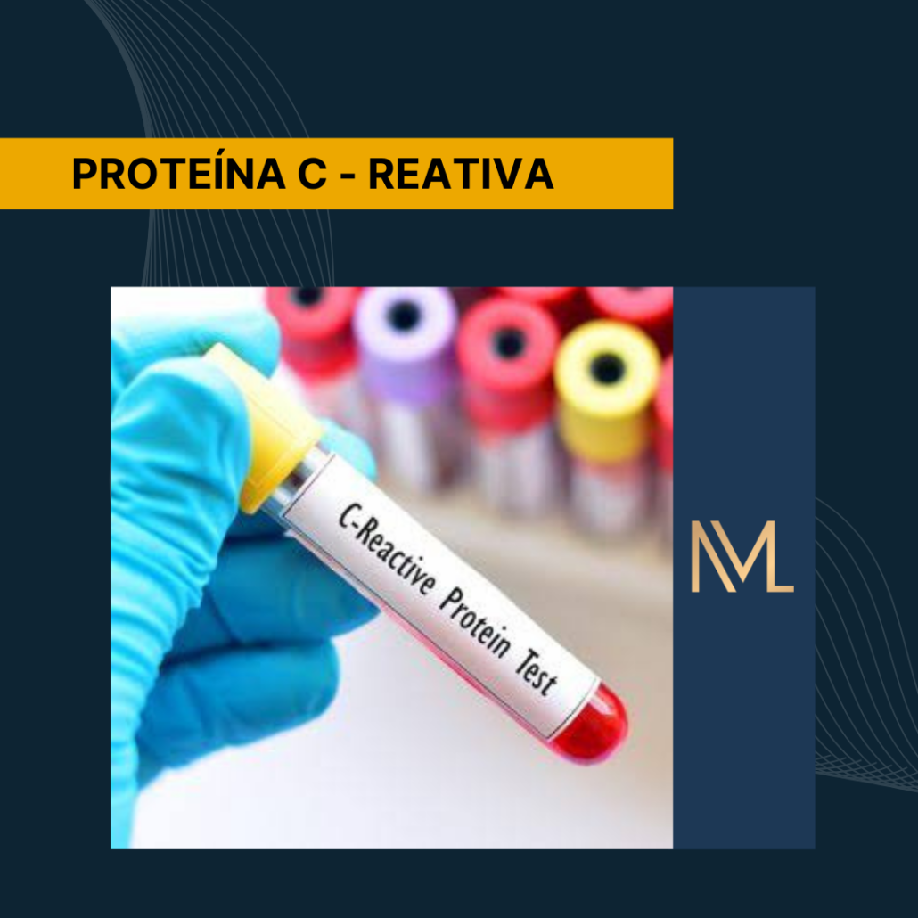 PCR na Investigação de Doenças Autoimunes: O Que Saber - inspiração 1