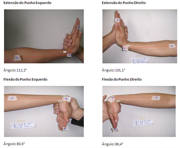 5 Exercícios para Fortalecimento de Punhos