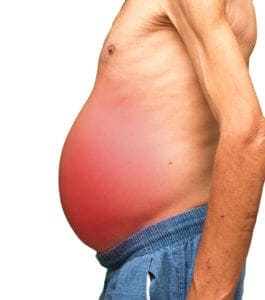 Como a Cirrose Hepática Leva à Ascite: Entenda a Relação